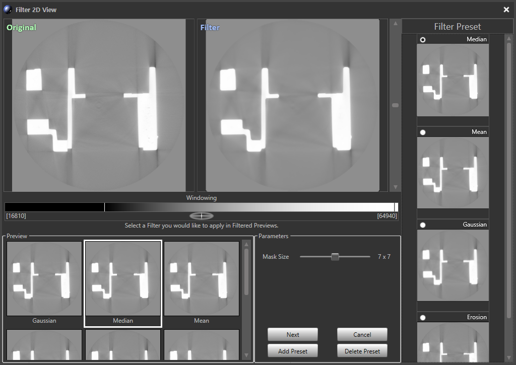 CT section comparison showing the original image and processed filter results